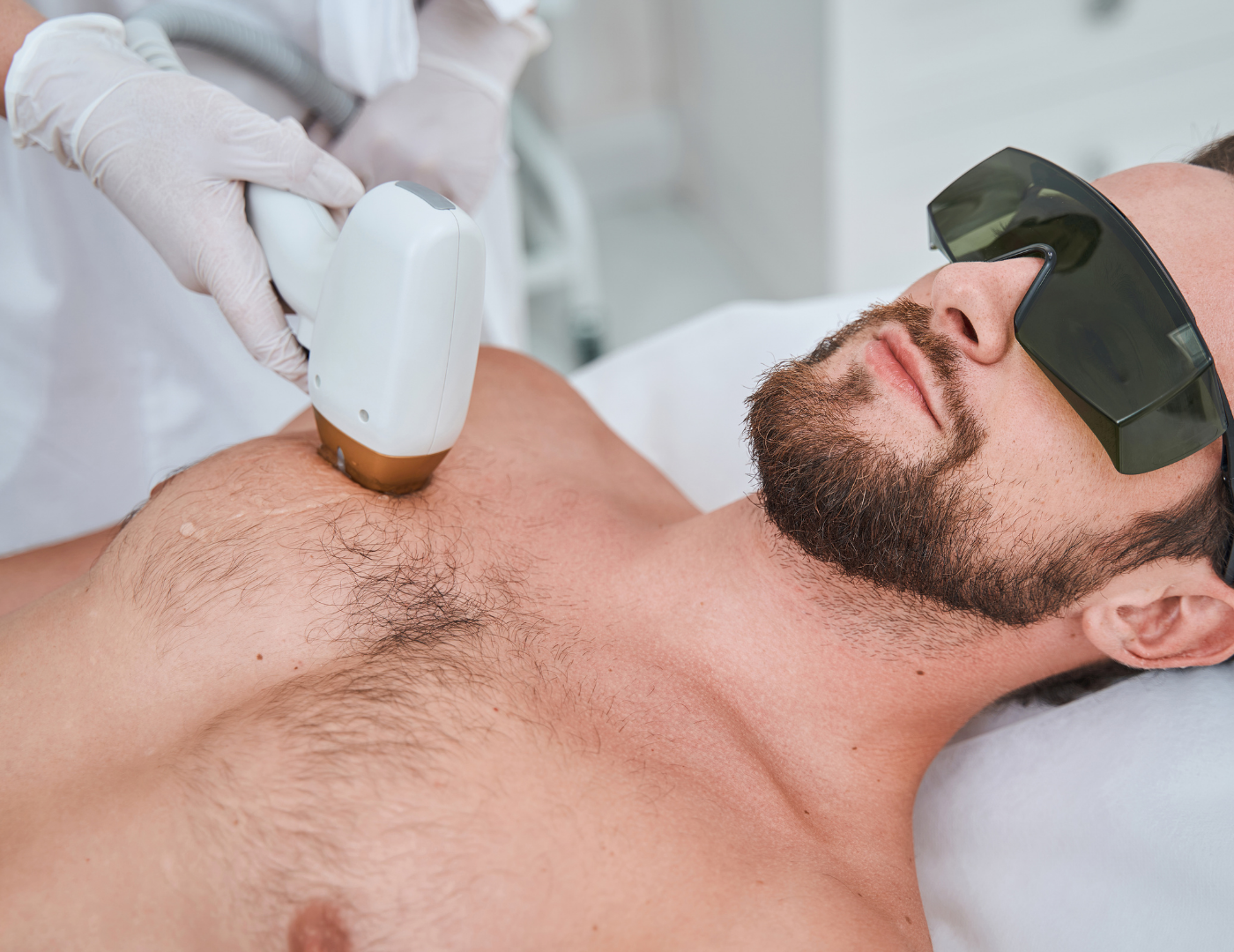 Men Laser Hair Removal Santorini
